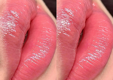 M-Lips